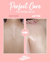 BODY PEELING PAD- Strong