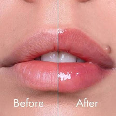 Reedle shot Lip Plumper Beginner