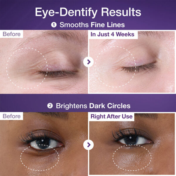 No.9 NAD+ Collagen Under Eye Patches (5 Pairs)