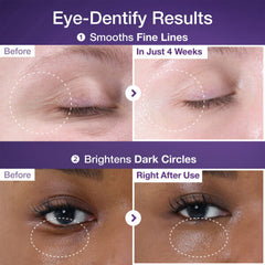 No.9 NAD+ Collagen Under Eye Patches (5 Pairs)