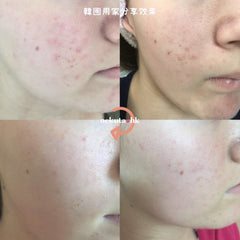 Clearteen Topical Acne Treatment 30ml