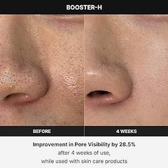AGE-R Booster-H