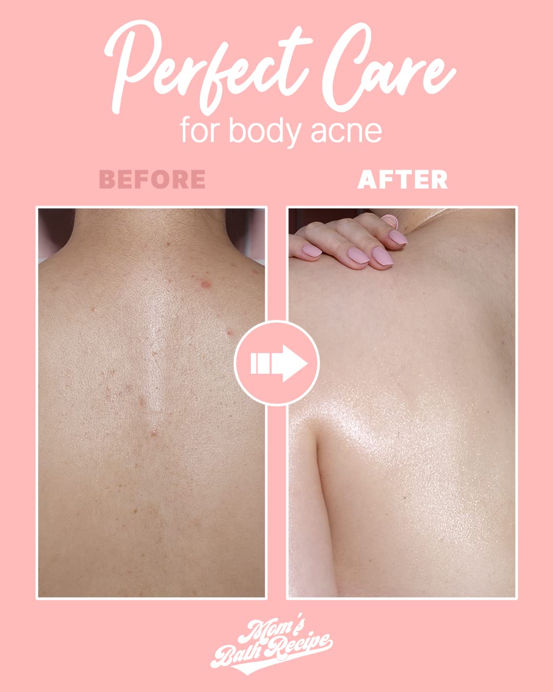 BODY PEELING PAD- Strong