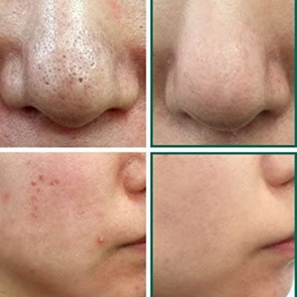 AHA. BHA. PHA. 30 Days Miracle Cleansing Bar