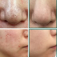 AHA. BHA. PHA. 30 Days Miracle Cleansing Bar