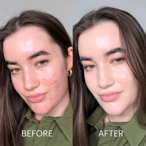 CICAPAIR™ TIGER GRASS COLOR CORRECTING TREATMENT SPF30 50ml