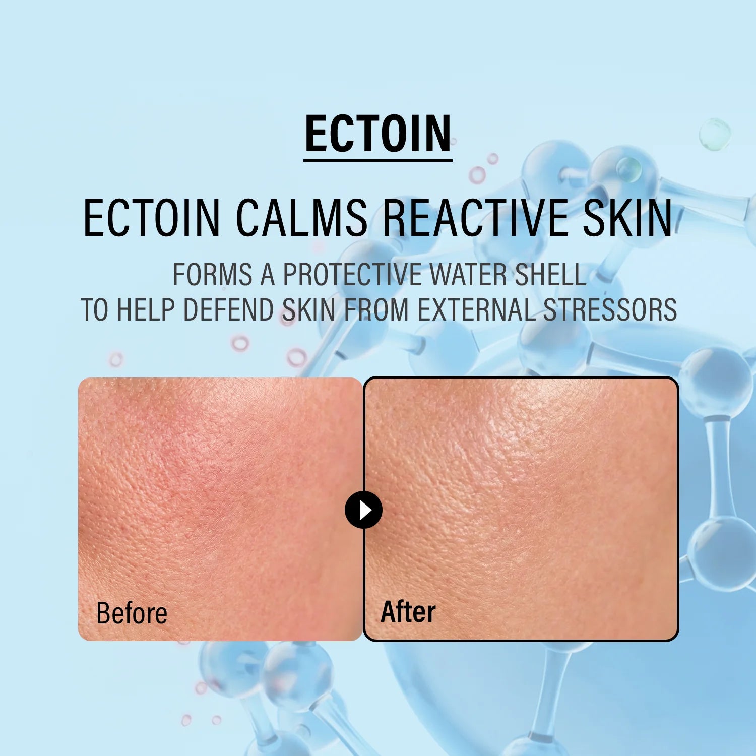 Double Up Cream Ectoin & Panthenol