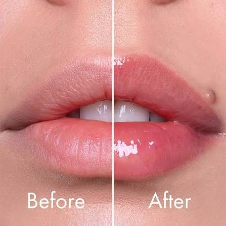 Reedle shot Lip Plumper Beginner