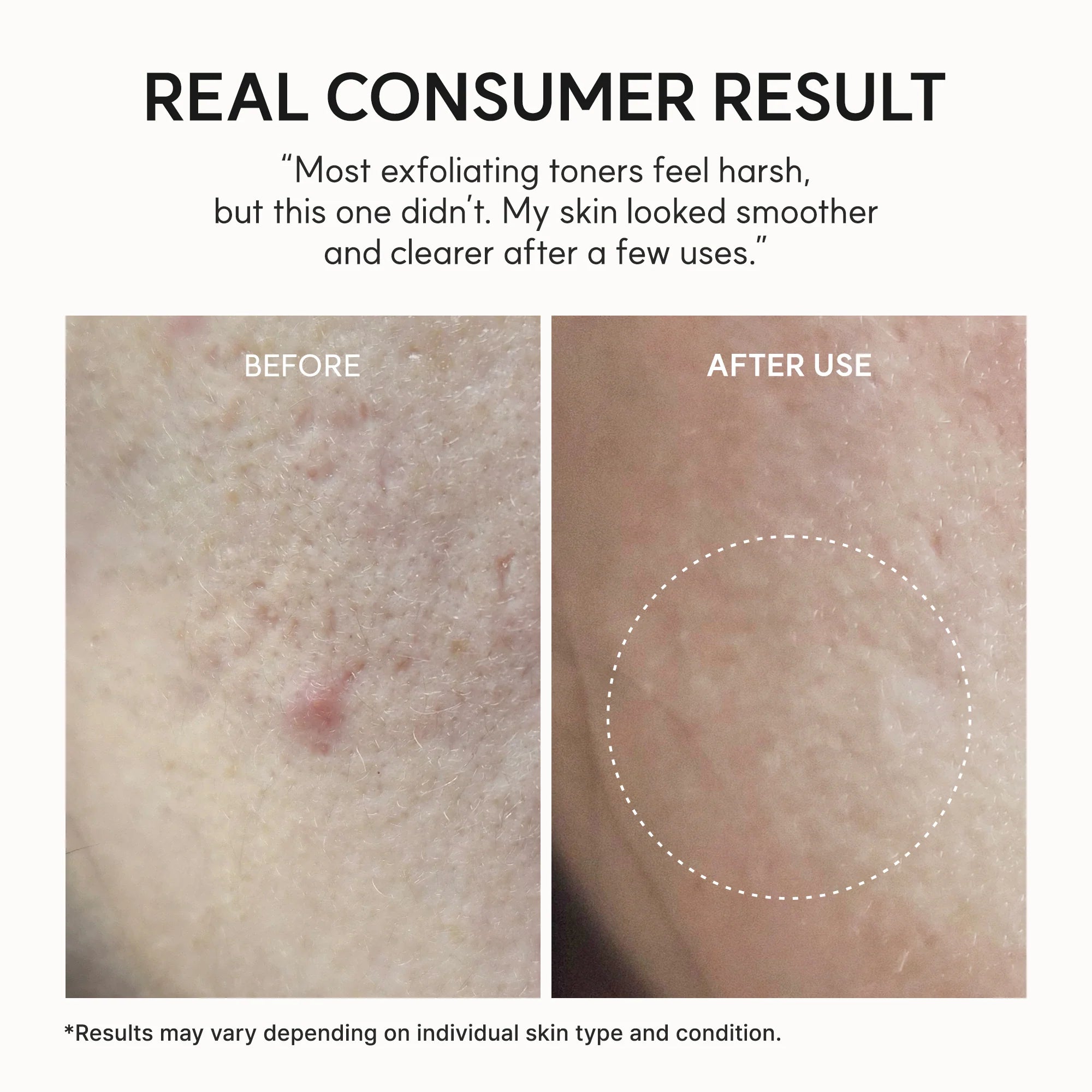 Eraser Shot Glycolic Acid Exfoliator