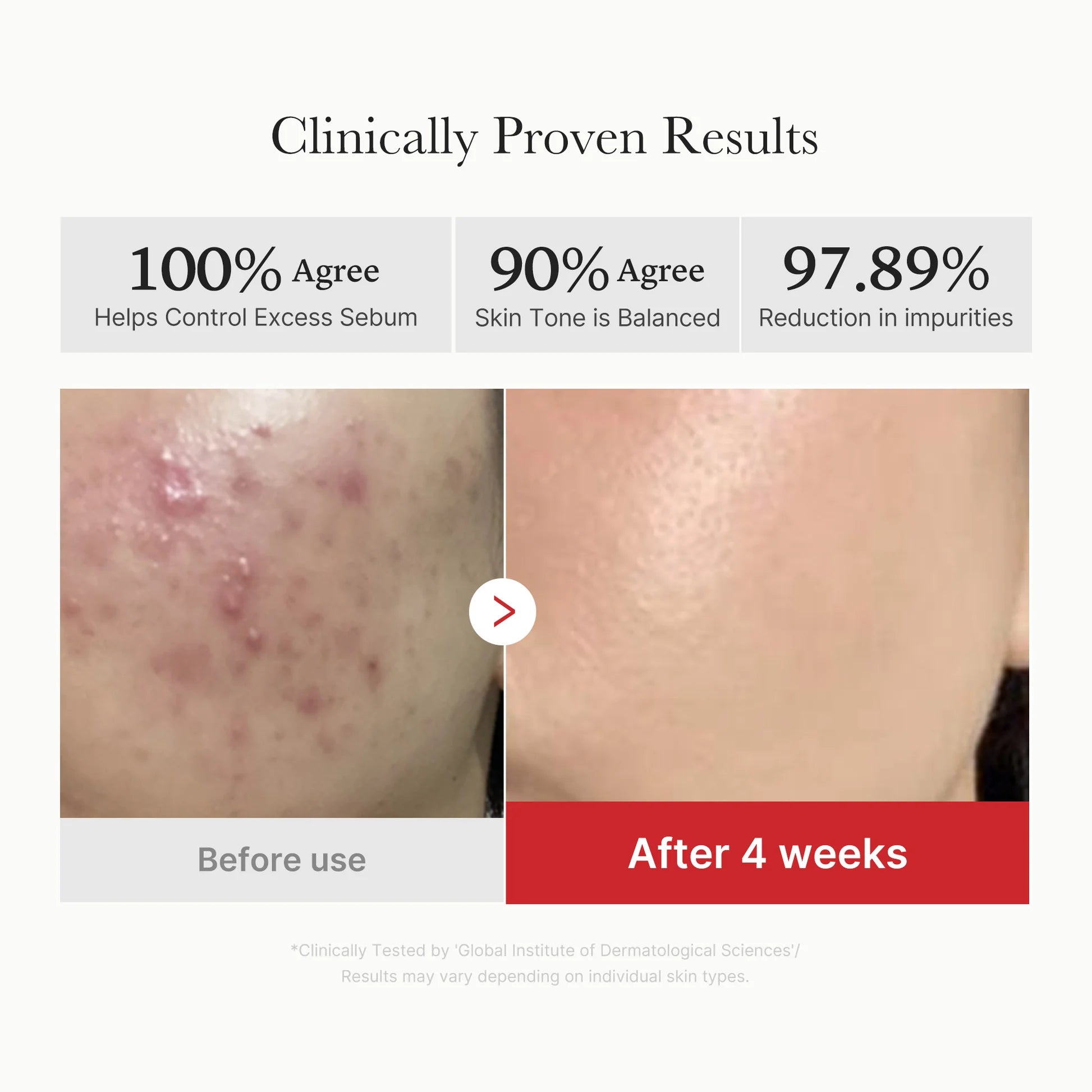 Red Succinic Acid Peeling Pads