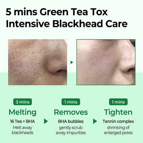 BYE BYE BLACKHEAD 30 DAYS MIRACLE GREEN TEA TOX